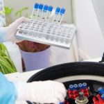 Castilla-La Mancha registró 1.228 casos por infección de COVID del 1 al 7 de agosto en personas mayores de 60 años